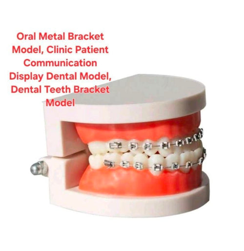 artificial teeth with fixed metal braces.