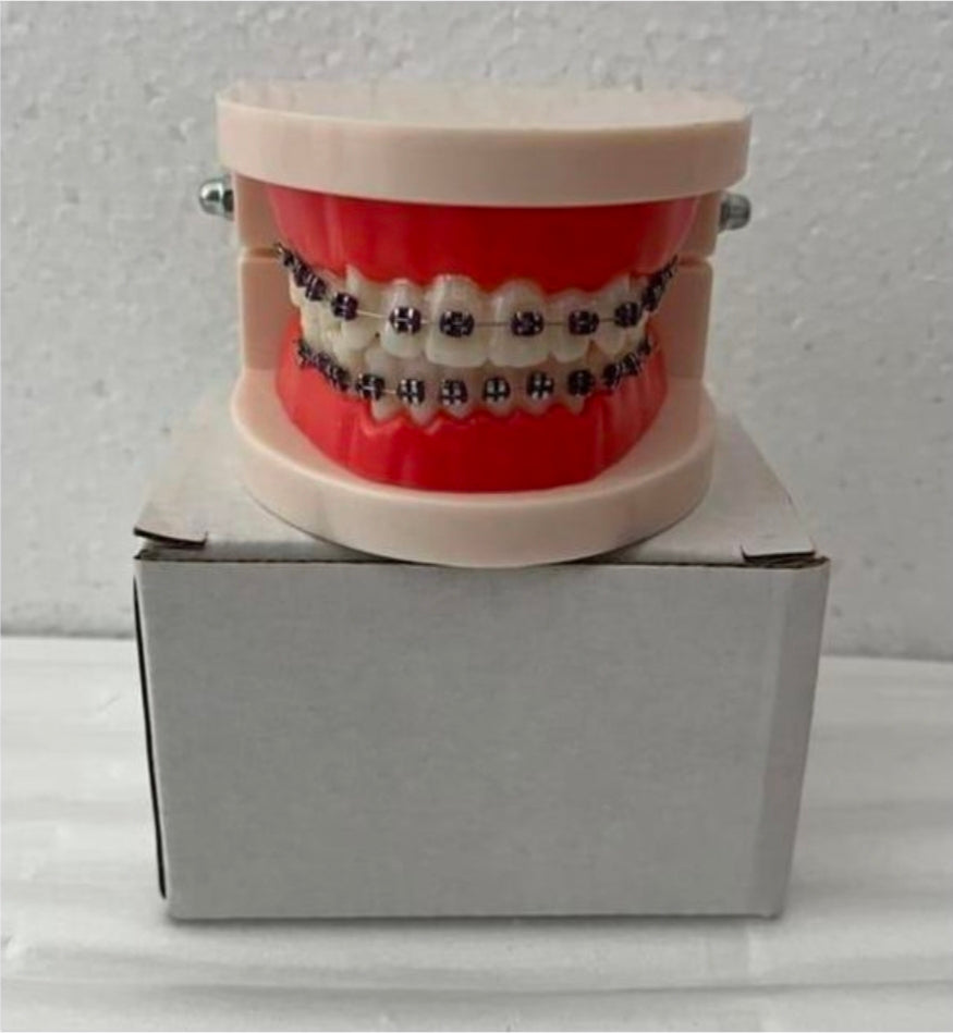 artificial teeth with fixed metal braces.