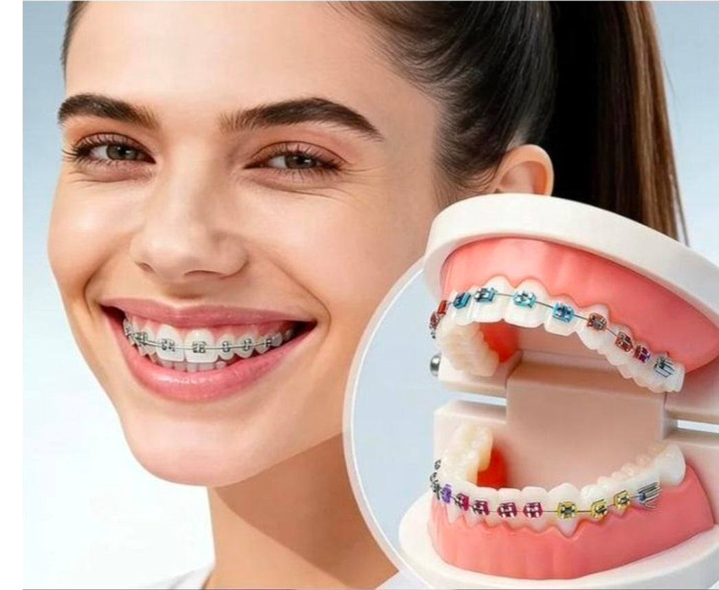 artificial teeth with fixed metal braces.